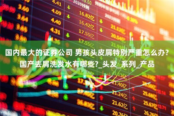 国内最大的证券公司 男孩头皮屑特别严重怎么办?国产去屑洗发水有哪些?_头发_系列_产品